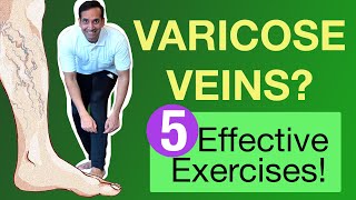 5 Exercises For Varicose Vein Care Hindi Yoga Mayur Karthik