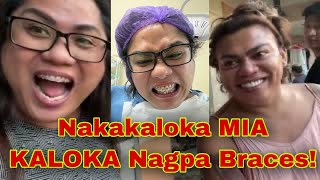 Download Lagu Nakakaloka Mag Pa Braces Vlog | Mia Kaloka MP3 Download Lagu Nakakaloka Mag Pa Braces Vlog | Mia Kaloka MP3