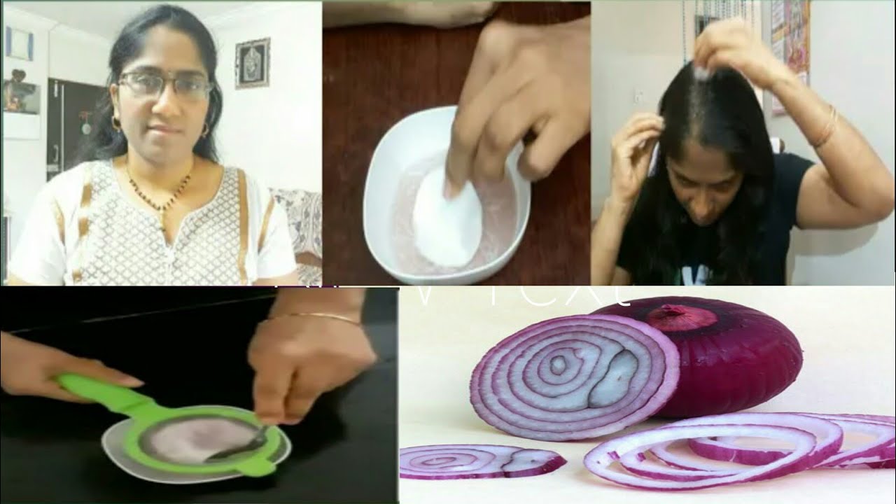 How to use Onion juice hair growth in Telugu // Hair pack and Home