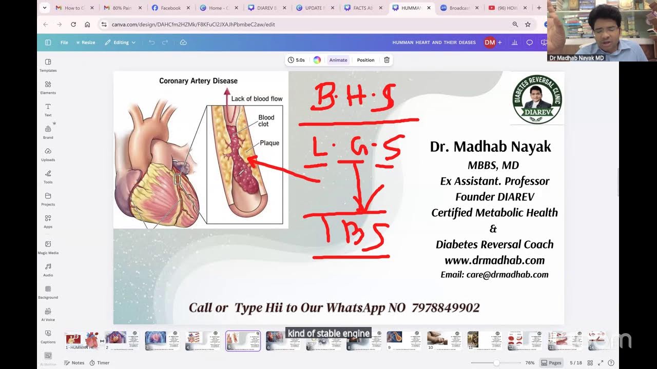 HOW TO CLEAN UP YOUR BLOCKED ARTERY Dr Madhab Nayak MD's Personal Meeting Room