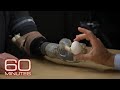 How advancements in prosthetic technology allow feeling, control | 60 Minutes