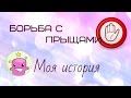 Борьба с прыщами/акне. Моя история. БАЗИРОН АС