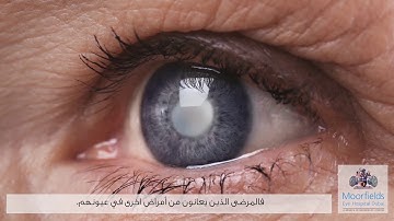 What is Refractive lens exchange surgery?