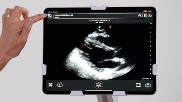 Reviewing and Deleting Images