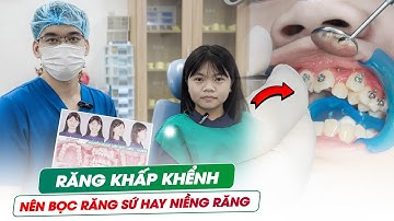 Xem Là Mê! Cận Cảnh Quá Trình Gắn Mắc Cài Cho Răng Khấp Khểnh Lệch Lạc