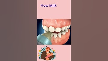 Thumbnail of How does Baby Bottle  Tooth Decay happen🍼#baby#milk#teeth#decay #cavity #shorts #dentist #babycare
