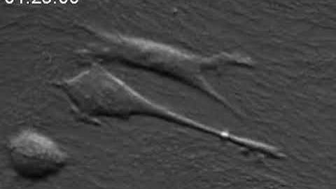 How cells rapidly create protrusions for exploration and movement