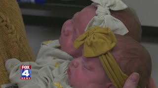 Rare 'MoMo' twins born at Overland Park Regional Medical Center Rare 'MoMo' twins born at Overland Park Regional Medical Center