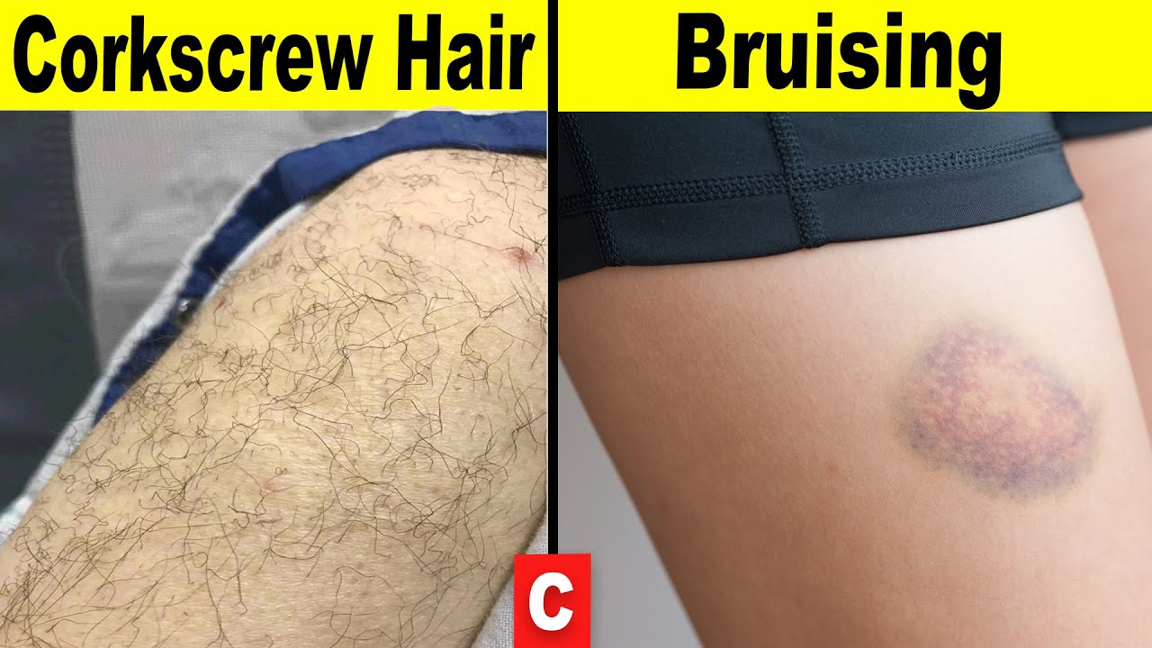 9 Signs Your Body Is Begging for Vitamin C YouTube