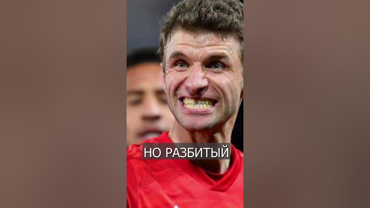 Томас Мюллер удар в голову