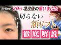 【26歳 切らない額リフト】瞼の重みで二重が不自然💦額リフトで目の開けやすさ、おでこのシワ改善✨【内視鏡前額リフト】