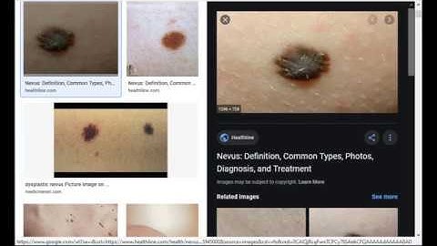 skin cancer classification using deep neural networks- DEMO