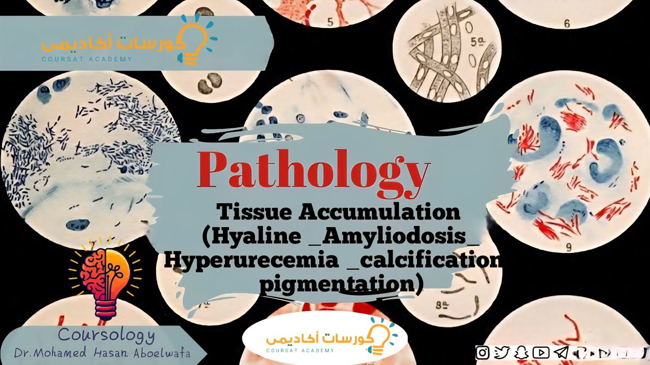 Tissue Accumulation (Hyaline _Amyliodosis_hyperureceimia_calcification_  pigmentation)