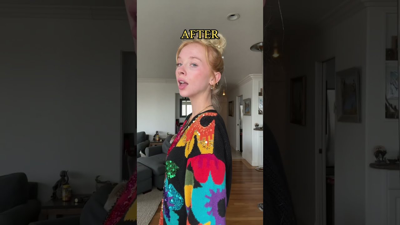 Chin Implant BEFORE AFTER Chinimplant Beforeandafter Plasticsurgery Glowup Plasticsurgeon