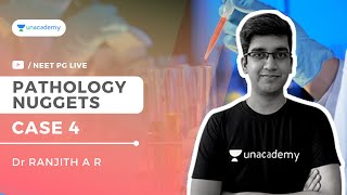 Pathology Nuggets: Case 4 | Dr Ranjith A R