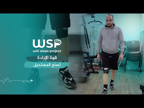 تركيب طرف صناعي لحالةبتر ساق تحت الركبة منظمة خطوات الإرادة أطراف صناعية مراكز خطوات الإرادة بتر 