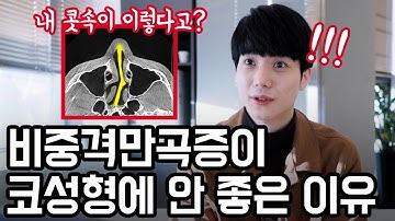 비중격만곡증 수술 꼭 해야 하나요? (예쁜 건 덤)