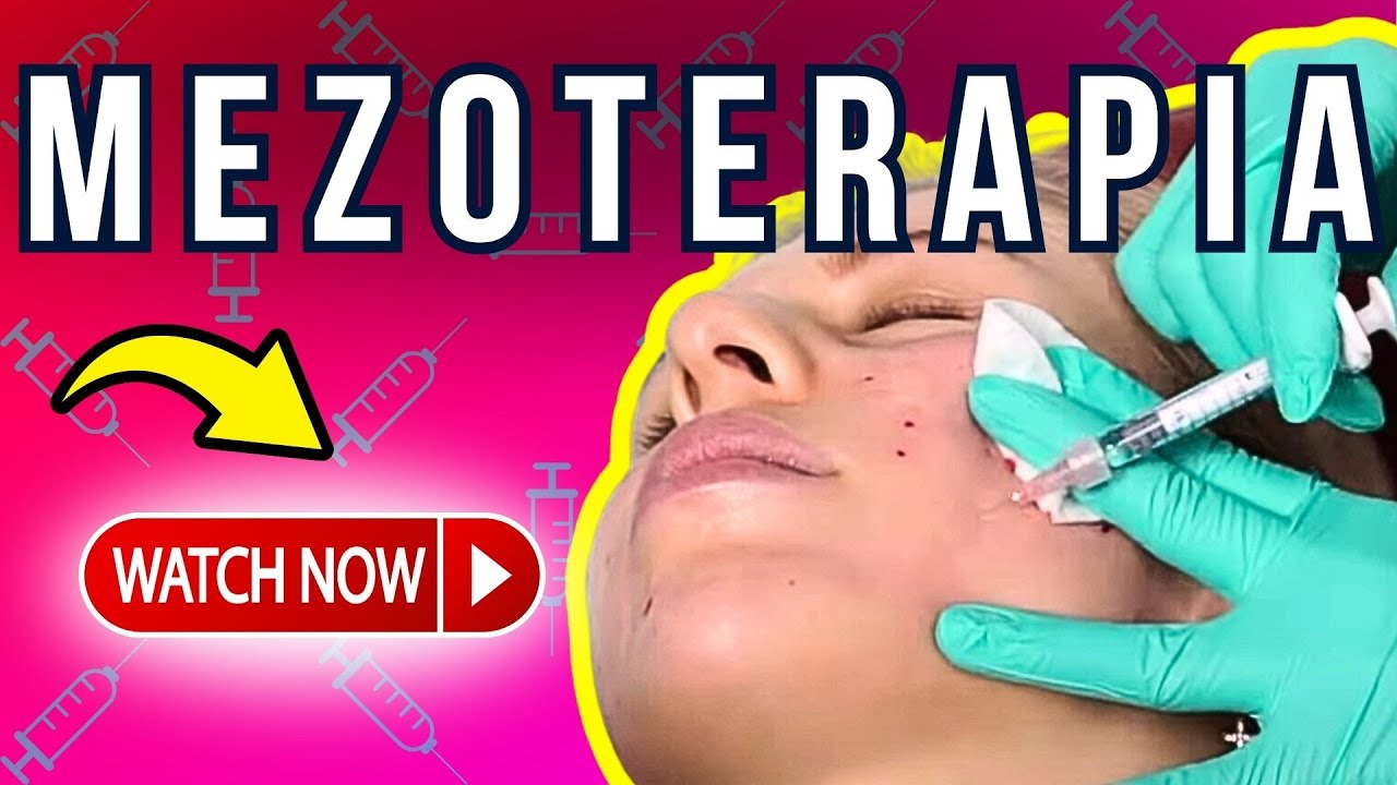 Czy Mezoterapia Igłowa MA SENS? Zobacz ZABIEG mezoterapii! | Doktor Monika - Medycyna Estetyczna