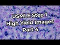 Usmle step 1 high yield images part 4 refreshed