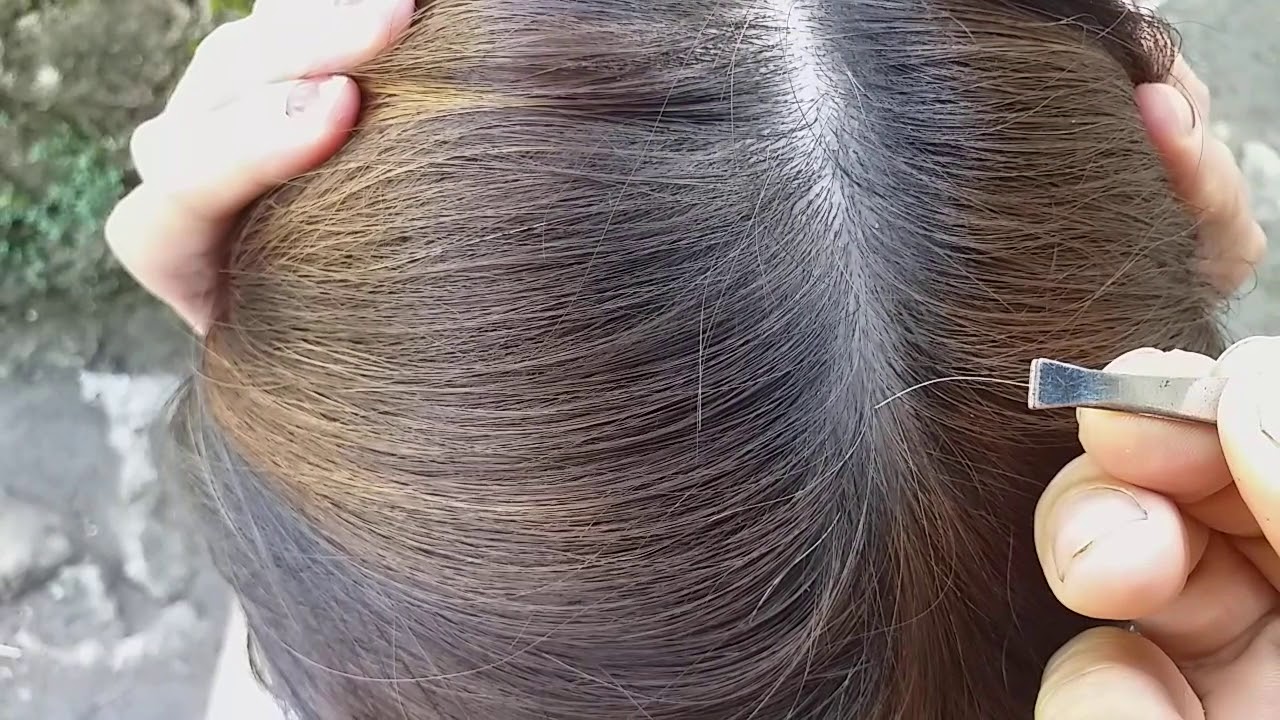Plucking white hair that makes head itching - YouTube
