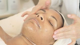 Brightening & Lightening Treatment for Crystal's Brown Spots