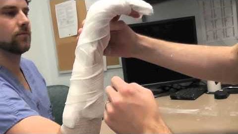 Dorsal Splint (How-to)