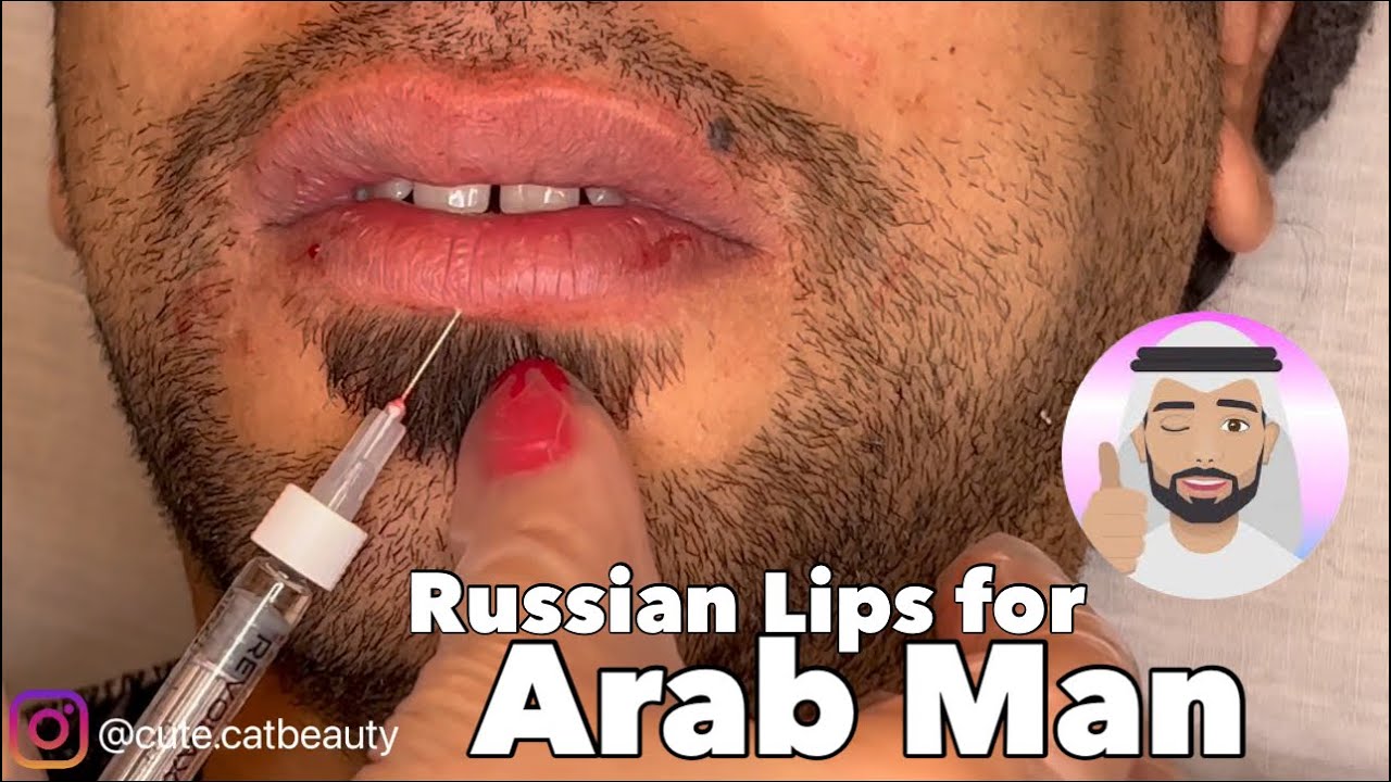 Russian Lips for my Arab Client - Arab Man Lips - YouTube