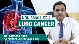 Treatment of Non-small cell lung cancer | Best Oncologist in Kolkata