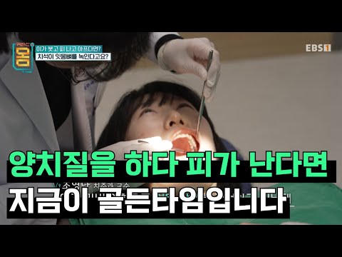 치과에서 가장 가성비 좋은 치료 방법🦷ㅣ이거 알면 <strong>치과</strong> <strong>비용</strong> 아낄 수 있습니다ㅣ붓고 피나는 잇몸 방치하면 안 되는 이유ㅣ#귀하신몸