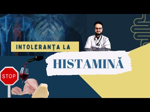 Intoleranța la histamină - un altfel de alergie