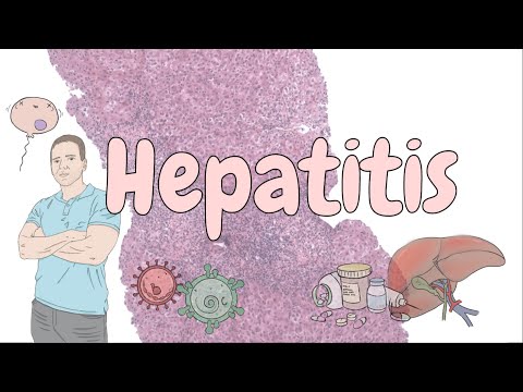 Hepatitis - liver pathology