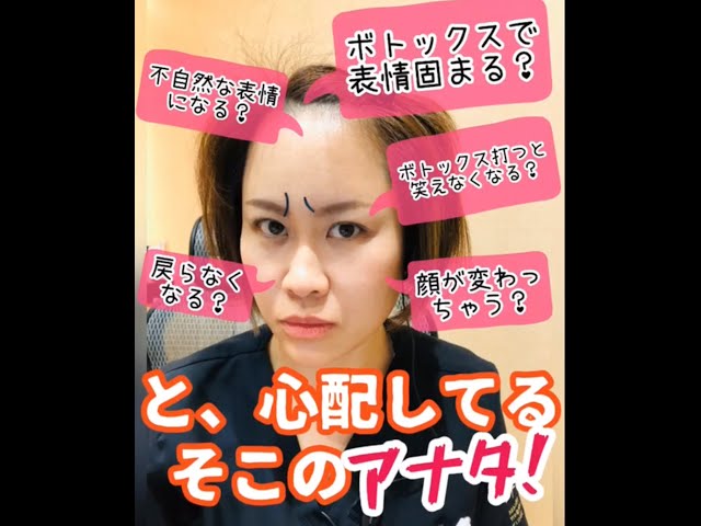 ボトックス止めといた方がいいんじゃない というボトックスを打ったことないお友達だけでなく 16年打ち続けた私の話も聞いて欲しい 西田美穂のボトックス マニア ボトックス止めといた方がいいんじゃない というボトックスを打ったことないお友達だけでなく 16年打ち続けた私の話も聞いて欲しい 西田美穂のボトックス マニア