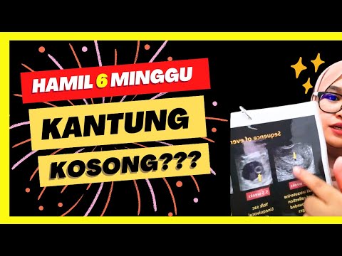 Video: Perlukah usg dilakukan dalam perut kosong?