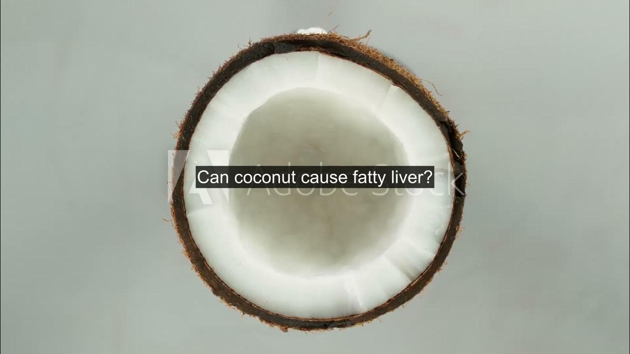 Can coconut cause fatty liver? - YouTube
