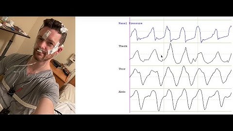 Orientation to Polysomnography