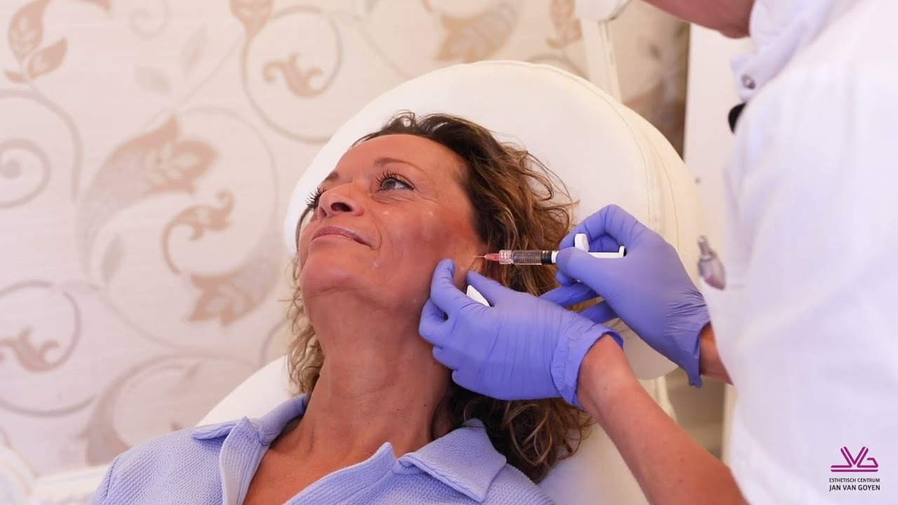 Profhilo behandeling bij Esthetisch Centrum Jan van Goyen in Amsterdam