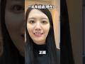 矯正開始から半年経過の様子公開！！！！#垢抜け #ビフォーアフター #矯正歯科