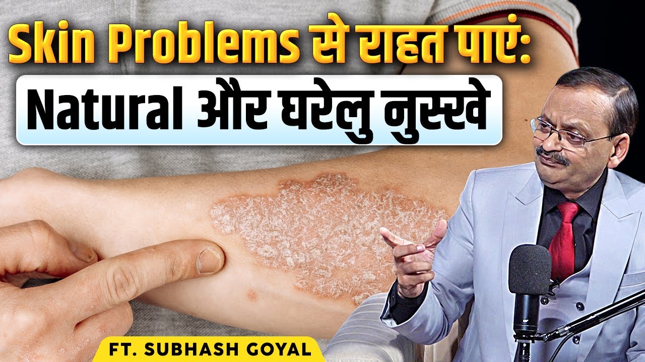Skin Problems से राहत पाएं: Natural और घरेलु नुस्खे | Subhash Goyal