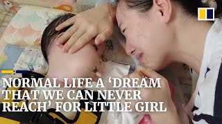 A normal life is a ‘dream that we can never reach’ for this little Chinese girl