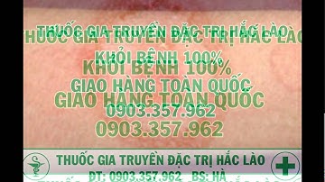 THUỐC CHỮA BỆNH HẮC LÀO ,BS:Hà 0903.357.962