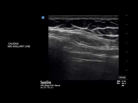 Diaphragmatic scanning using