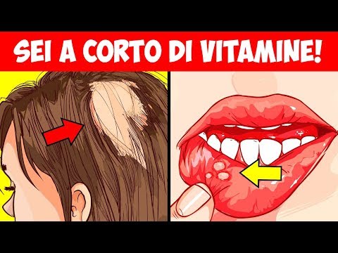 gli-8-segnali-di-avvertimento-che-il-tuo-corpo-è-carente-di-vitamine-essenziali