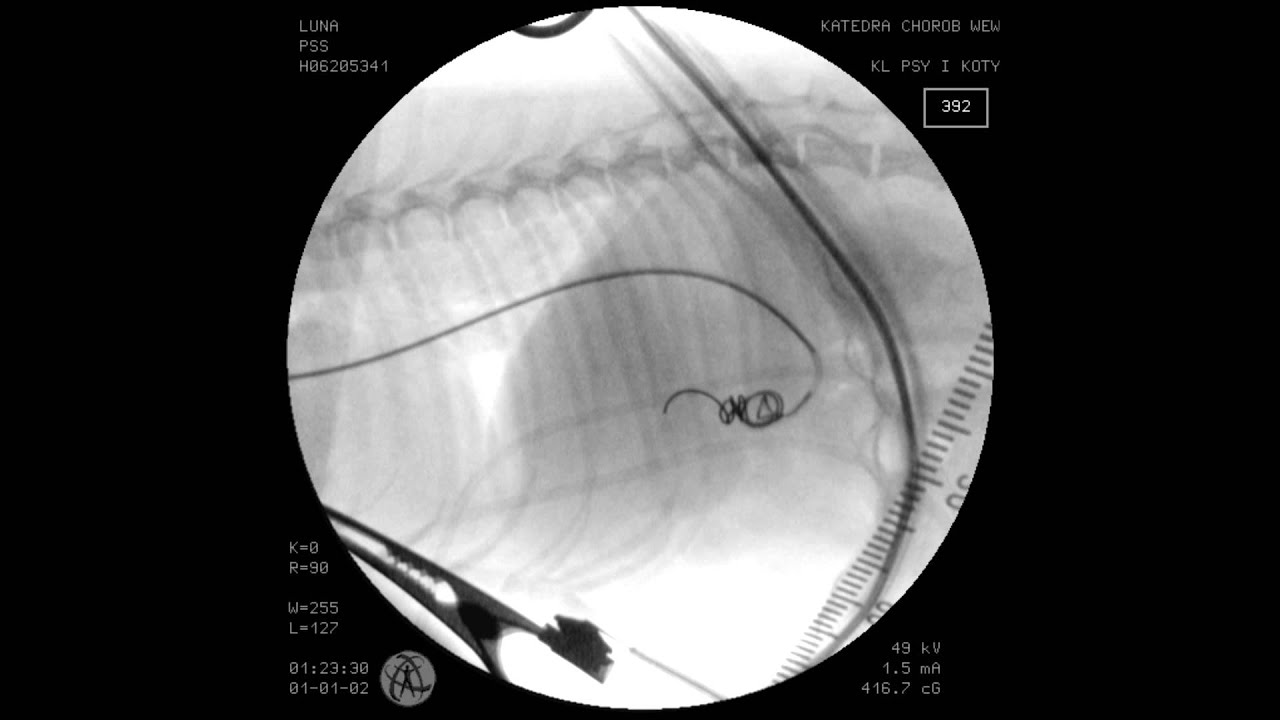 portosystemic shunt in yorkies transjugular portosystemic shunt coil embolization in a 2 5 kg portosystemic shunt in yorkies transjugular portosystemic shunt coil embolization in a 2 5 kg