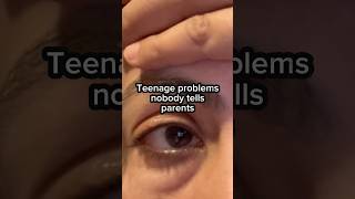 Teenage Problems Nobody Tells Parents | Pakistani Mom in UK 😔