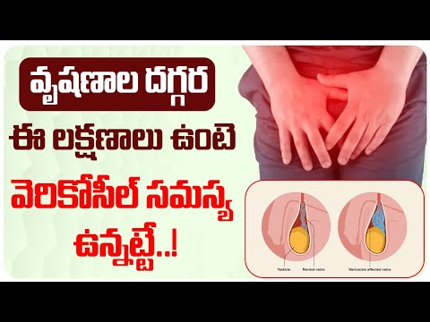 How to Cure Varicocele Without Surgery || Varicocele Symptoms in Telugu || Treatment Range Health