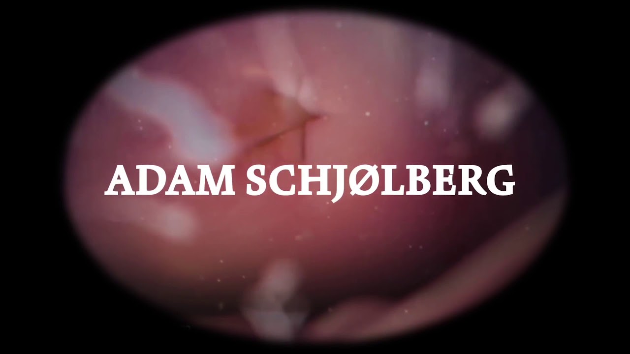 Adam Schjølberg