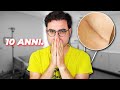 10 ANNI DOPO IL MIO TUMORE - Come sto?
