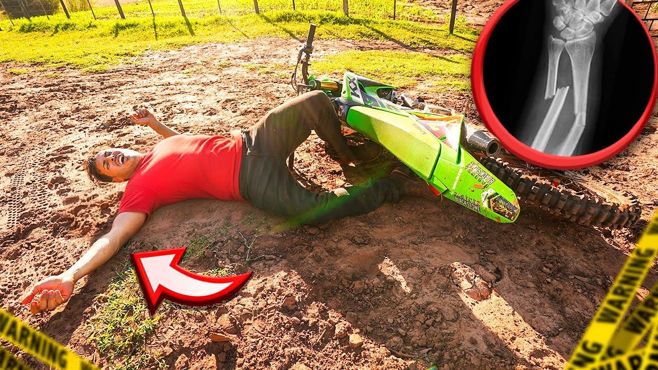 NAO DEVIA TER ANDANDO DE MOTO, INFELIZMENTE QUEBREI MEU BRAÇO