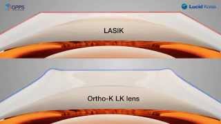 Ortho-K LK Lens