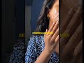 Serum Vida Acceptance Dhaan Powerful 💧|Real Skin Journey| #28ThingsBefore28" #avalsirumegam #shorts